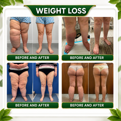 ✅𝐎𝐟𝐟𝐢𝐜𝐢𝐚𝐥 𝐁𝐫𝐚𝐧𝐝 𝐒𝐭𝐨𝐫𝐞 |👩‍⚕️𝑮𝒓𝒆𝒆𝒏𝑭𝒆𝒆𝒍® 𝑩𝒆𝒓𝒃𝒆𝒓𝒊𝒏𝒆 𝑴𝒐𝒓𝒊𝒏𝒈𝒂- 𝑩𝒆𝒆 𝑽𝒆𝒏𝒐𝒎 Metabolic Wellness Foot Soak Beads
