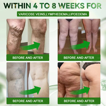 ✅𝐎𝐟𝐟𝐢𝐜𝐢𝐚𝐥 𝐁𝐫𝐚𝐧𝐝 𝐒𝐭𝐨𝐫𝐞 |👩‍⚕️𝑮𝒓𝒆𝒆𝒏𝑭𝒆𝒆𝒍® 𝑩𝒆𝒓𝒃𝒆𝒓𝒊𝒏𝒆 𝑴𝒐𝒓𝒊𝒏𝒈𝒂- 𝑩𝒆𝒆 𝑽𝒆𝒏𝒐𝒎 Metabolic Wellness Foot Soak Beads