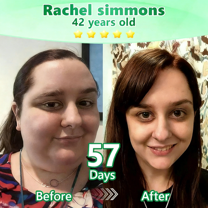 𝐂𝐚𝐫𝐞𝐔𝐩𝐥𝐢𝐟𝐭® has a surprise upgrade just for you! You've already got an amazing offer — but now you've unlocked an even better one:👉 You'll get a massive 30% off your next purchase — for the next five minutes only!